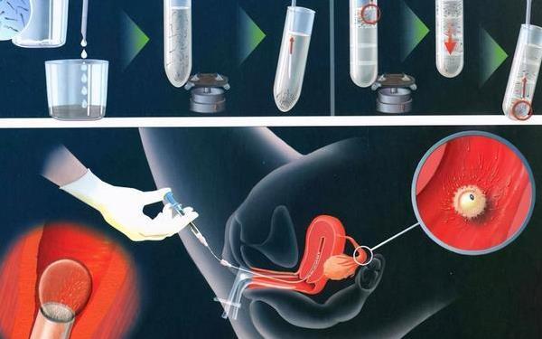 供卵试管有必要做无创检查吗_供卵试管：是否需要无创检查？