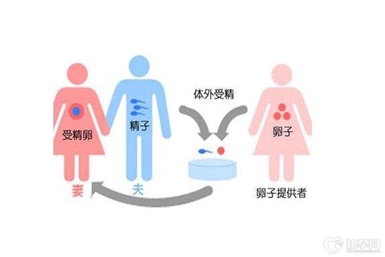 供卵试管需要什么条件-供卵试管：条件是什么？